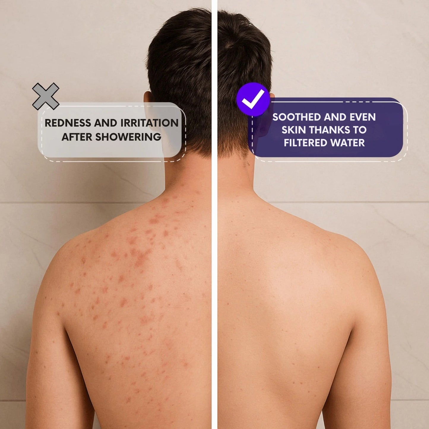 Zoxzy™ - The Filtered Showerhead